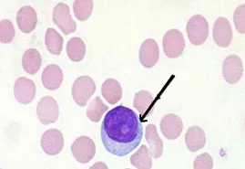 临床医学检验技术考试历年真题精练119 第2张