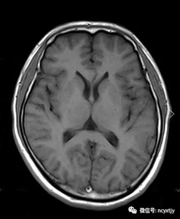 放射技术士师中历年真题考点pdf版(2025年、2024年、2023年、2022年、2021年、2019年、2017年) 第31张