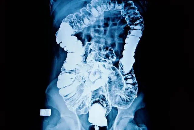 中考化学复习:胃病里的酸碱盐考点 第15张 中考化学复习:胃病里的酸碱盐考点 第15张