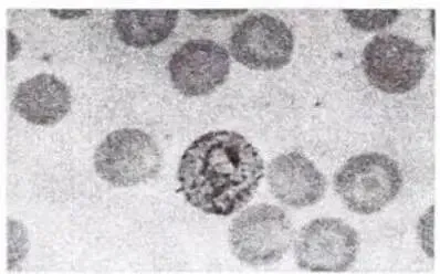 2023年检验师《专业知识》真题 第1张