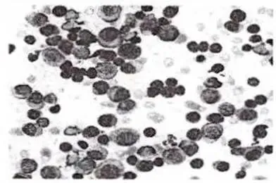 2023年检验师《专业知识》真题 第2张