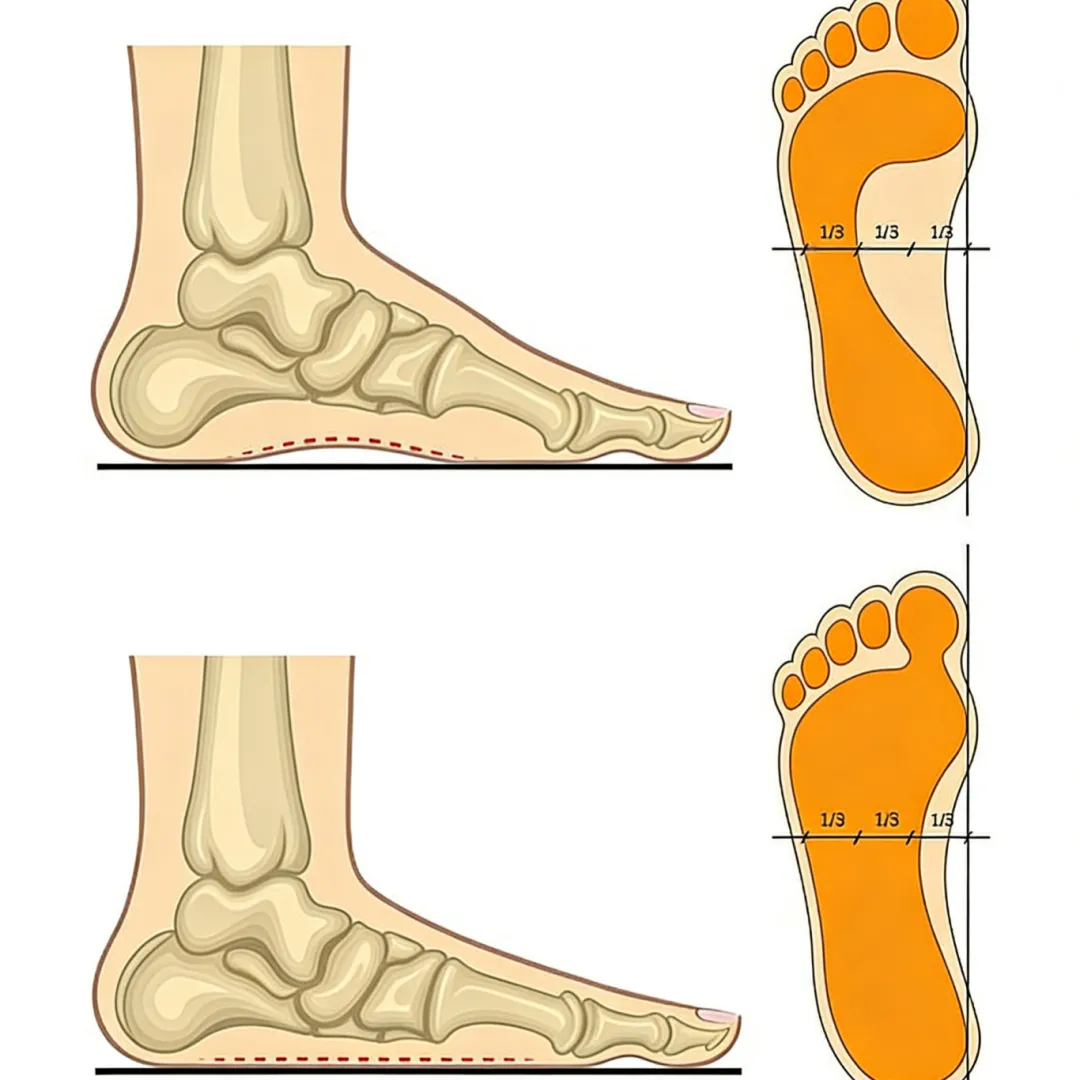 体育中考 | “跑得更轻松”的秘密——柳州妇幼康复医学科从步态分析中给你指导 第7张