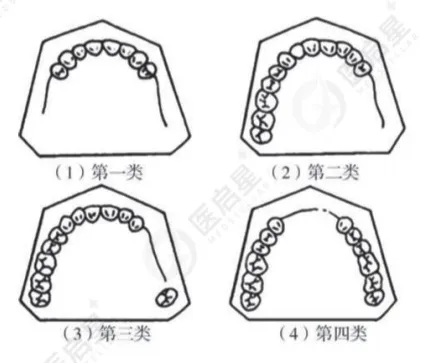 【历年真题】口腔技能病例分析诊断及治疗 记住这些23分稳了. 第7张