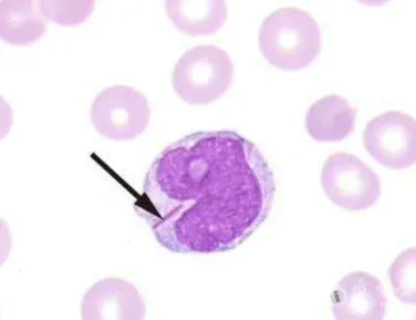 临床医学检验技术考试历年真题精练111 第2张