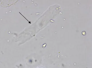 临床医学检验技术考试历年真题精练108 第2张 临床医学检验技术考试历年真题精练108 第2张