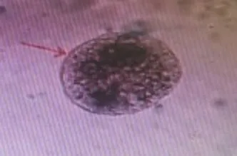 临床医学检验技术考试历年真题精练135 第2张