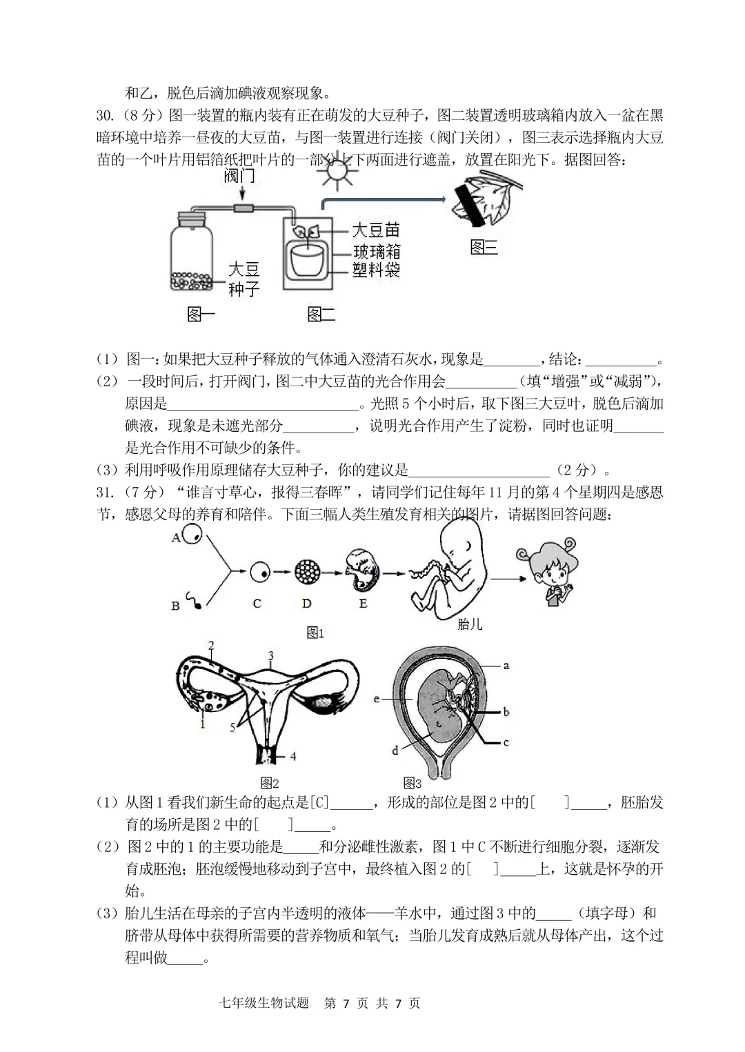 期中真题-2025 年临沂兰陵县初一下学期期中生物试题(完整版 + 答案) 第10张