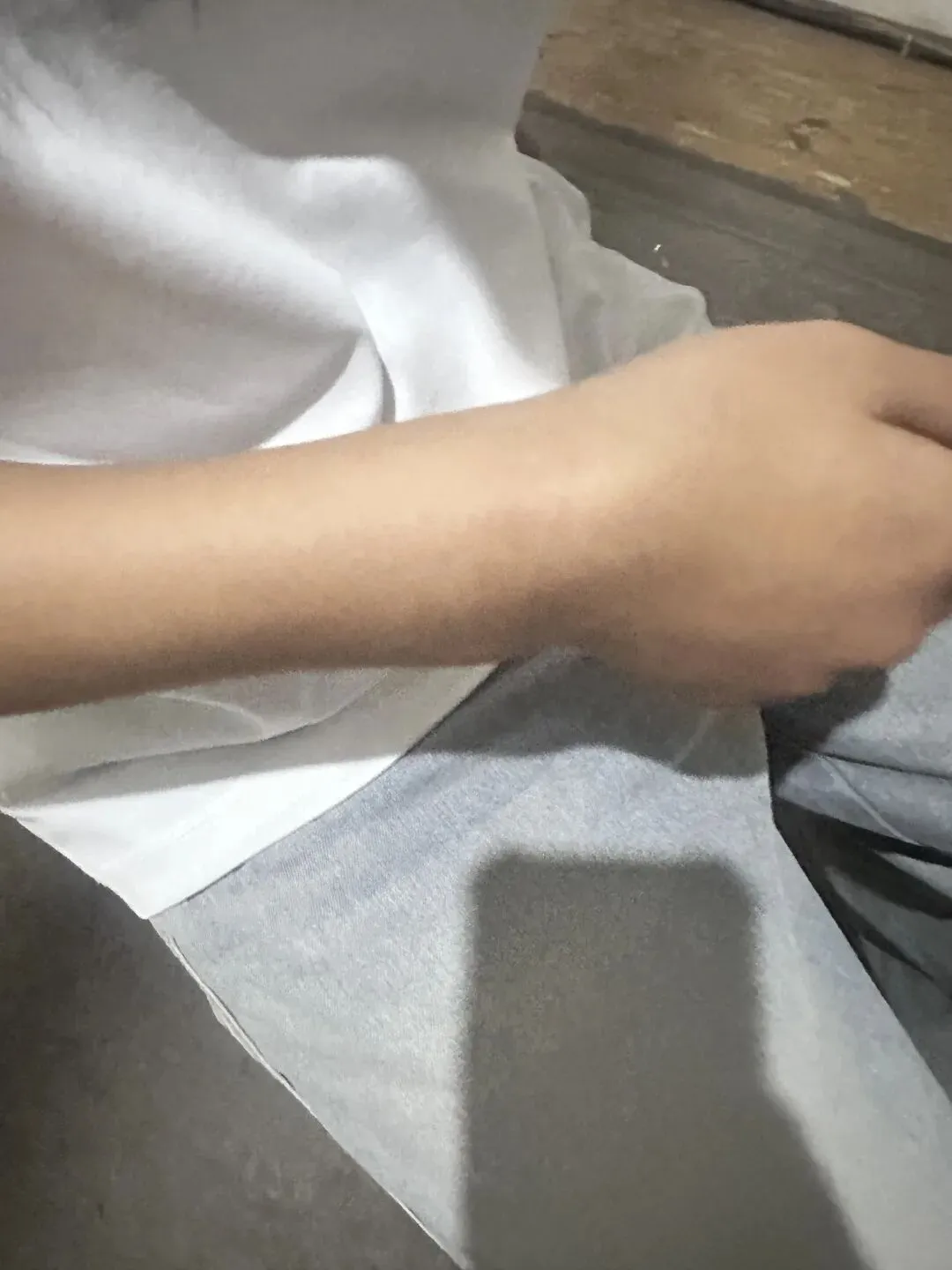 初三娃意外骨折,体育中考或丢20多分!一位陪读妈妈的揪心提醒与求助 第1张