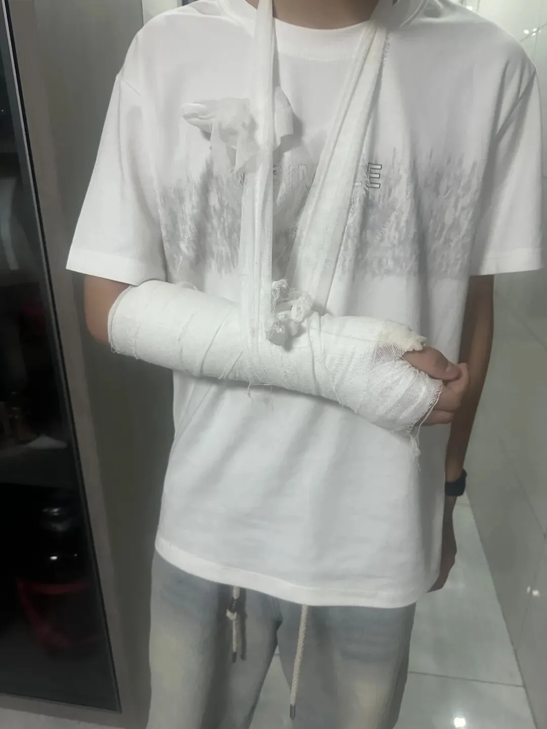 初三娃意外骨折,体育中考或丢20多分!一位陪读妈妈的揪心提醒与求助 第5张