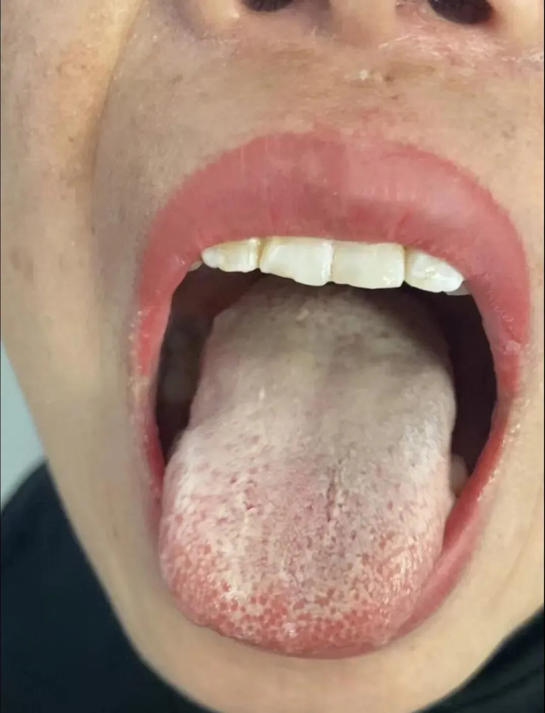 会议纪要10~中考学生身心调理、妇科疑难杂症与肿瘤术后调理的建议 第1张