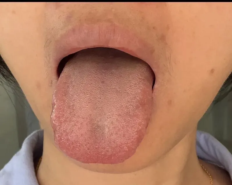 会议纪要10~中考学生身心调理、妇科疑难杂症与肿瘤术后调理的建议 第3张