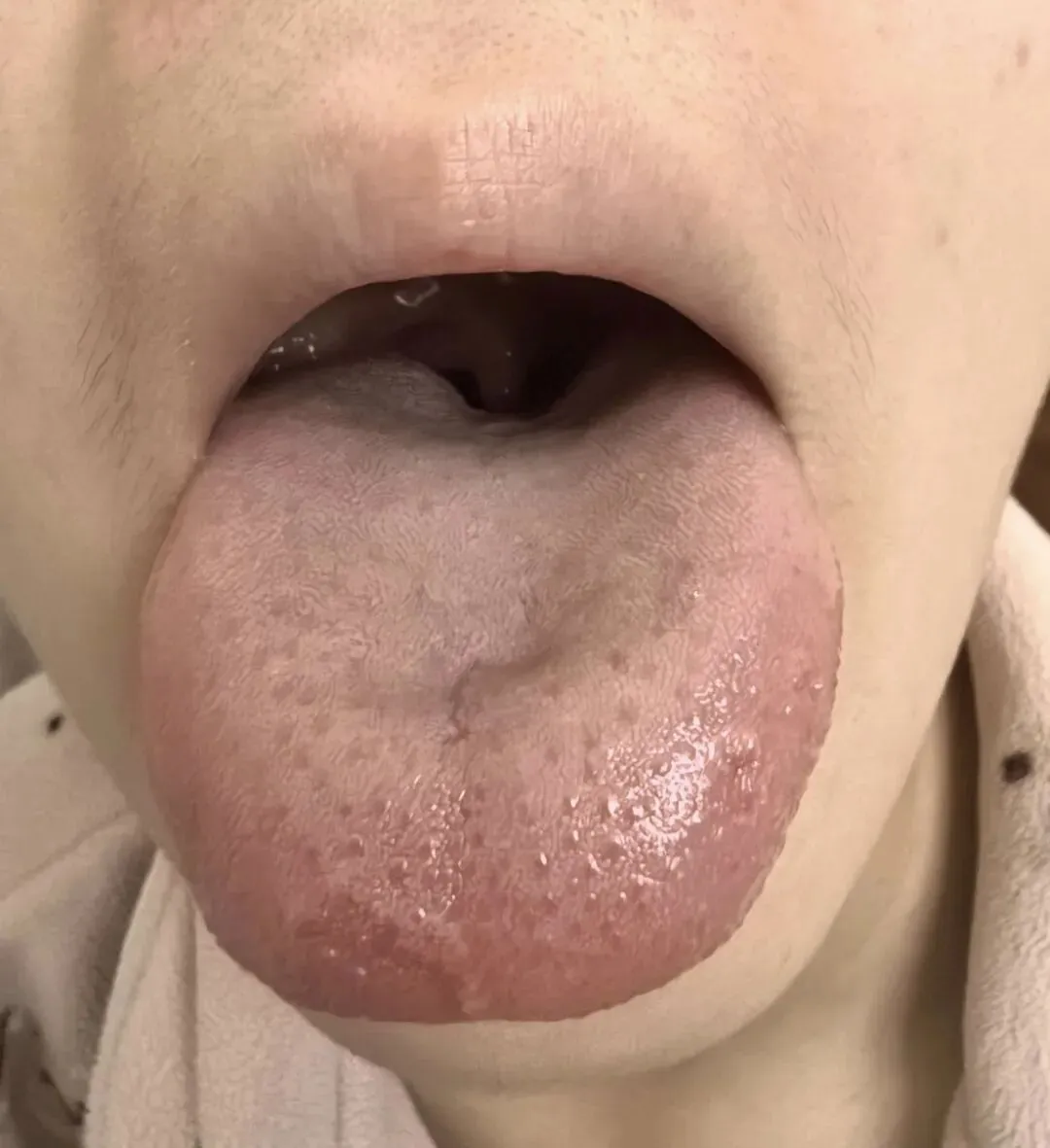 会议纪要10~中考学生身心调理、妇科疑难杂症与肿瘤术后调理的建议 第5张