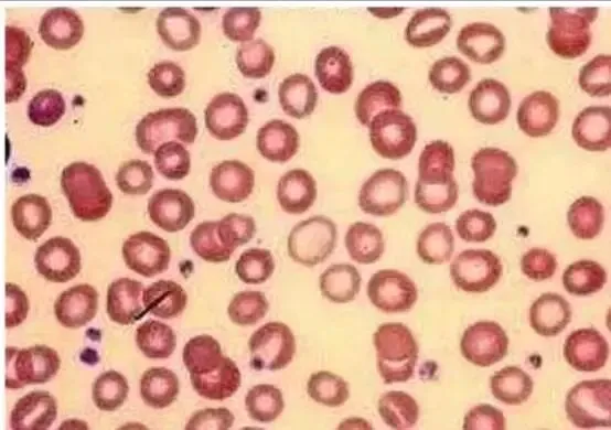 【检验职称真题 ·汇总4】 第2张