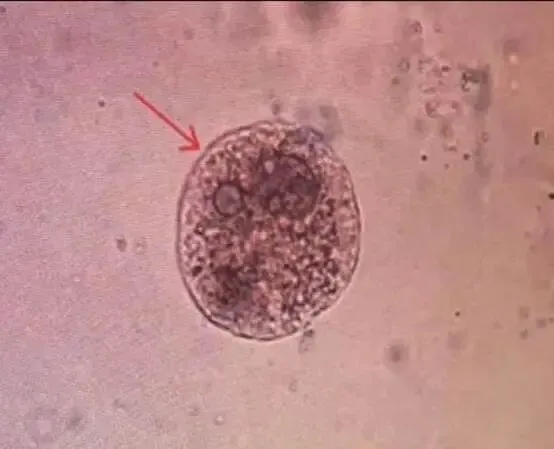 【检验职称真题 ·汇总4】 第3张