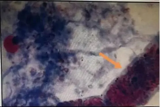 【检验职称真题 ·汇总4】 第4张