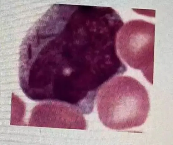 【检验职称真题 ·汇总4】 第5张