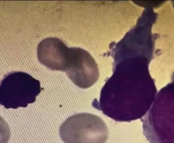 【检验职称真题 ·汇总4】 第6张