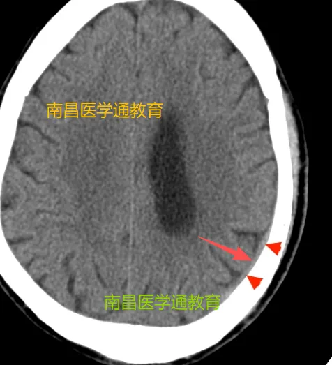 【2026真题】这道题你选什么? 第2张