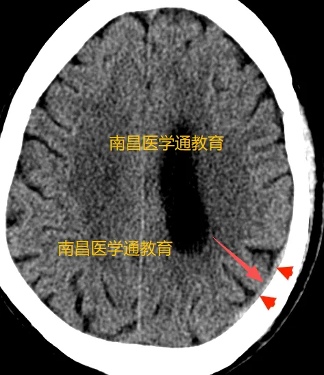 【2026真题】这道题你选什么? 第3张