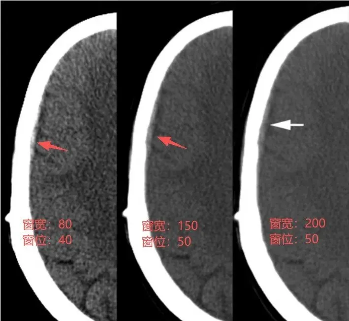 【2026真题】这道题你选什么?--后续 第2张
