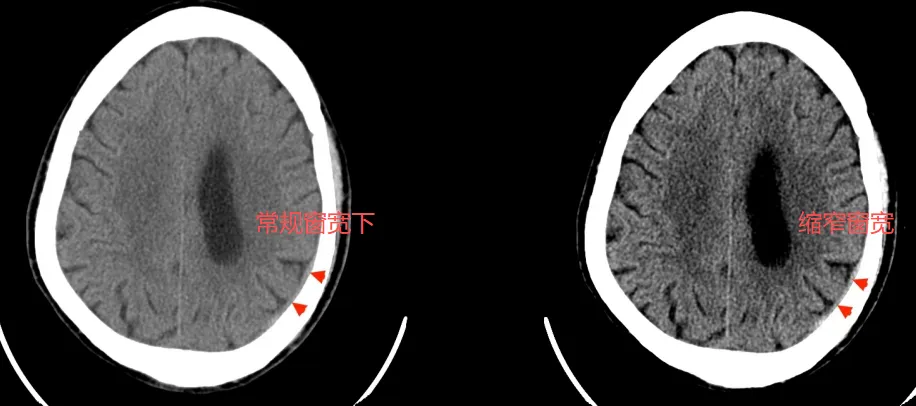 【2026真题】这道题你选什么?--后续 第3张