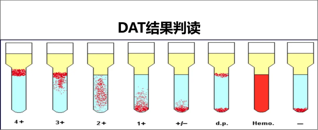 历年真题反复考!凝集反应这几个坑,检验技师考生90%都踩过 第7张