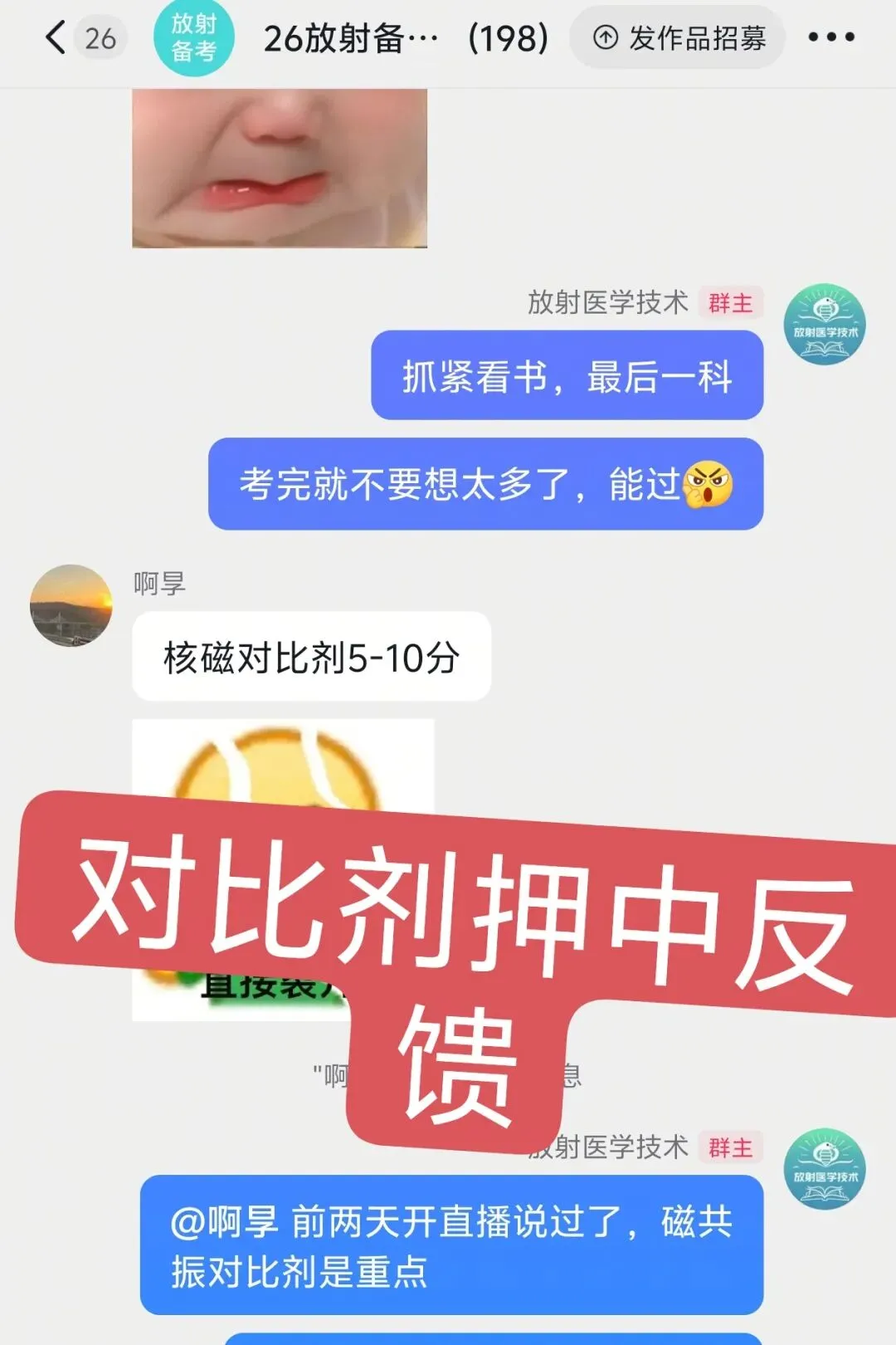 【最全】26年放射医学中级(376)真题回忆! 第119张