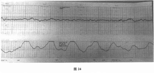 妇产科学(正高)[代码:019]-历年真题集,考前预测密卷、核心冲刺卷、考前通关领航卷、领航冲刺课,绝密千题 第8张