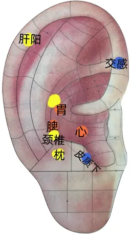 耳穴疗法 | 中考和高考前,会耳穴的你可以为考生做点什么?-第5张图片-四季读书网