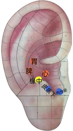 耳穴疗法 | 中考和高考前,会耳穴的你可以为考生做点什么?-第6张图片-四季读书网