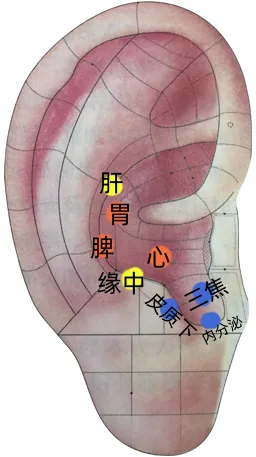 耳穴疗法 | 中考和高考前,会耳穴的你可以为考生做点什么?-第7张图片-四季读书网