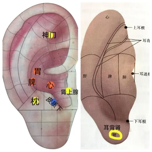 耳穴疗法 | 中考和高考前,会耳穴的你可以为考生做点什么?-第8张图片-四季读书网