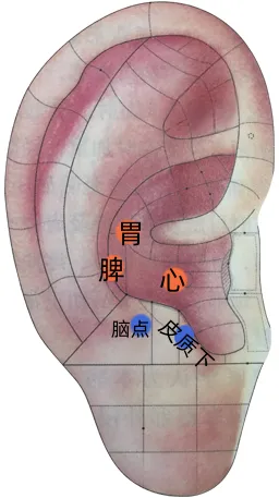 耳穴疗法 | 中考和高考前,会耳穴的你可以为考生做点什么?-第10张图片-四季读书网