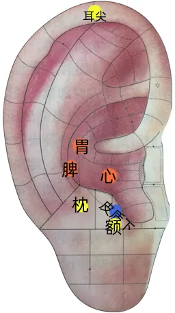 耳穴疗法 | 中考和高考前,会耳穴的你可以为考生做点什么?-第11张图片-四季读书网