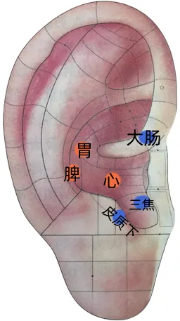 耳穴疗法 | 中考和高考前,会耳穴的你可以为考生做点什么?-第12张图片-四季读书网