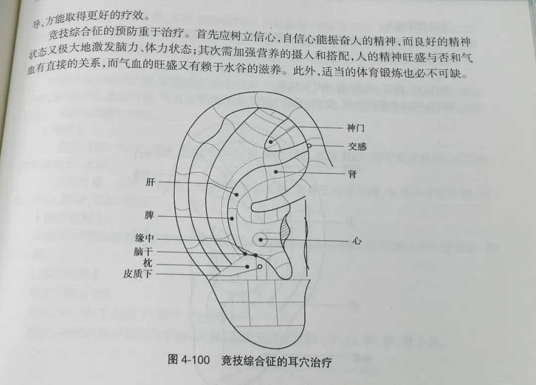 耳穴疗法 | 中考和高考前,会耳穴的你可以为考生做点什么?-第20张图片-四季读书网