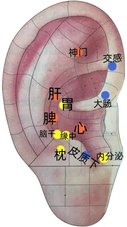耳穴疗法 | 中考和高考前,会耳穴的你可以为考生做点什么?-第24张图片-四季读书网