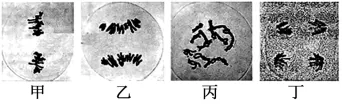 试题精选║安徽省合肥一中2026届高三5月模拟考试生物学试题-第6张图片-四季读书网