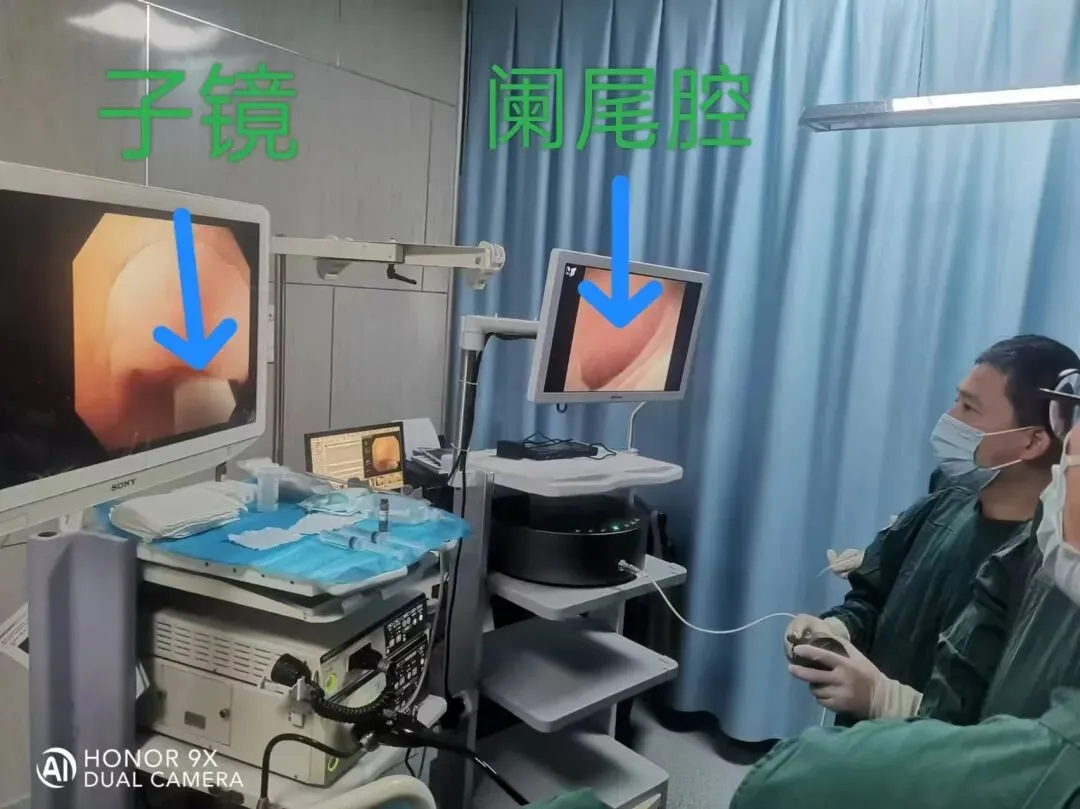 中考/高考在即,大名县人民医院开通阑尾炎ERAT治疗绿色通道-第10张图片-四季读书网 中考/高考在即,大名县人民医院开通阑尾炎ERAT治疗绿色通道-第10张图片-四季读书网