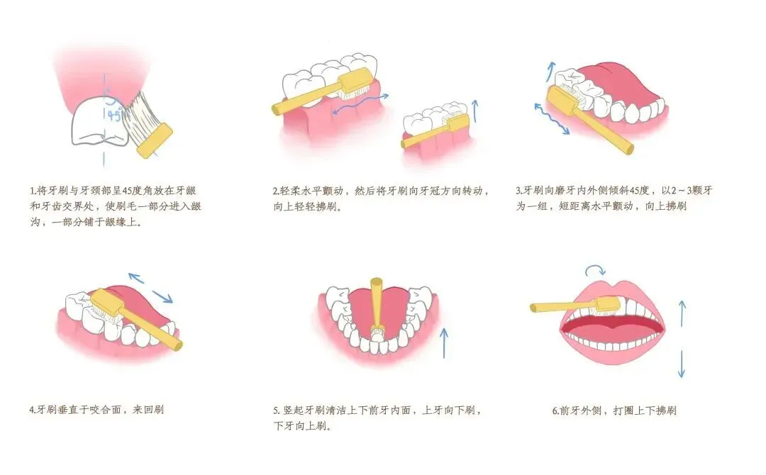 原来如“齿” | 高考、中考季,为何容易突发口腔急症?-第2张图片-四季读书网