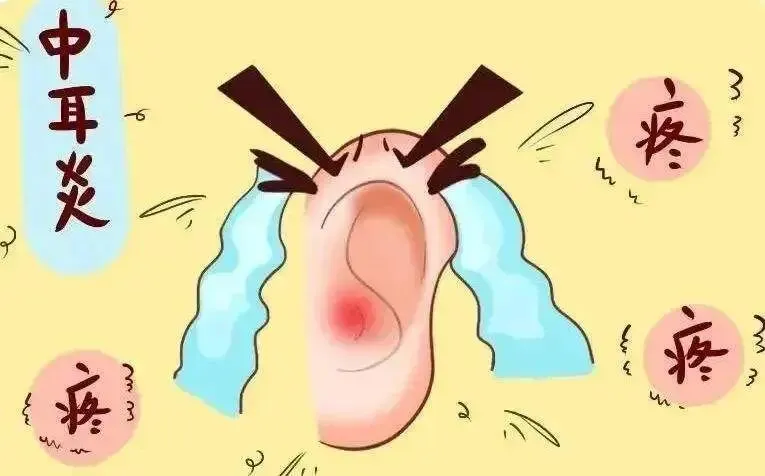 中考在即,别让这些耳鼻疾病成为孩子的“拌脚石”-第5张图片-四季读书网 中考在即,别让这些耳鼻疾病成为孩子的“拌脚石”-第5张图片-四季读书网