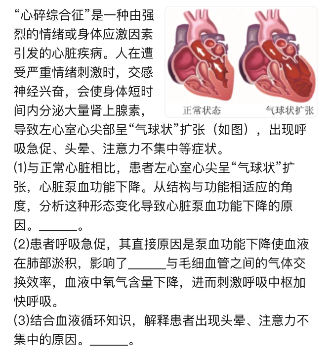 中考科学高频易错——一道涉及心脏的错题分析-第1张图片-四季读书网