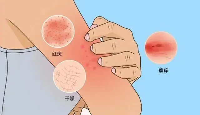 中考攻略 | 守护身心健康,让努力皆有回响-第16张图片-四季读书网