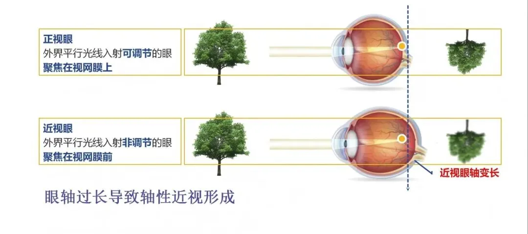 中考冲刺别让眼睛拖后腿!这份护眼指南请收好-第4张图片-四季读书网 中考冲刺别让眼睛拖后腿!这份护眼指南请收好-第4张图片-四季读书网