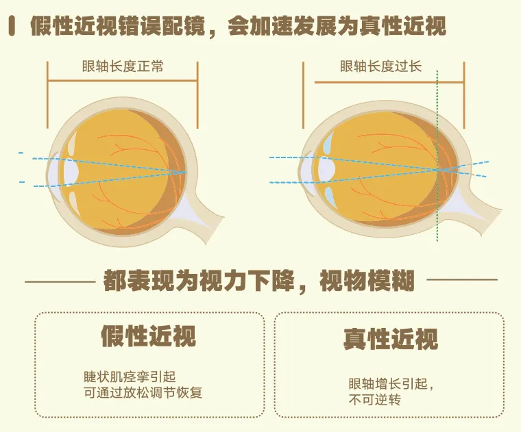 中考冲刺,眼科医生提醒:这3个护眼方法比刷题更重要-第2张图片-四季读书网 中考冲刺,眼科医生提醒:这3个护眼方法比刷题更重要-第2张图片-四季读书网