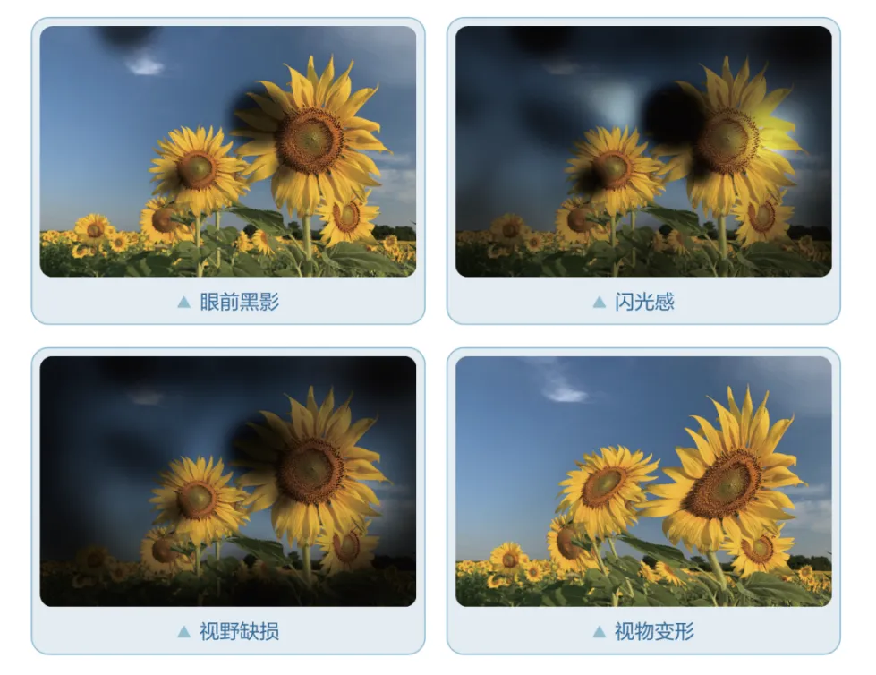 中考倒计时,近视600度以上的考生别忘做这件事!-第9张图片-四季读书网 中考倒计时,近视600度以上的考生别忘做这件事!-第9张图片-四季读书网