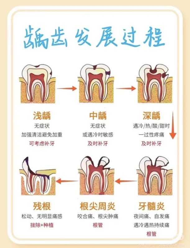中考结束后,看牙正当时——北大滨海口腔祝你齿间无忧 前程似锦-第5张图片-四季读书网 中考结束后,看牙正当时——北大滨海口腔祝你齿间无忧 前程似锦-第5张图片-四季读书网