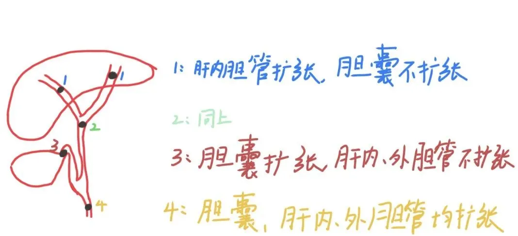 2026执业医师真题考点自查 1 期-第5张图片-四季读书网 2026执业医师真题考点自查 1 期-第5张图片-四季读书网