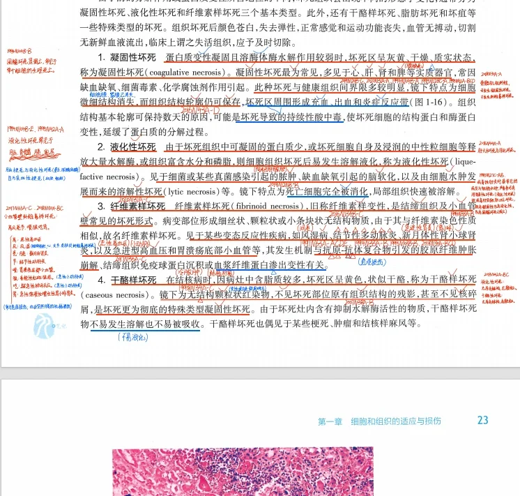25考研西综真题笔记，我的宝子不准没有！