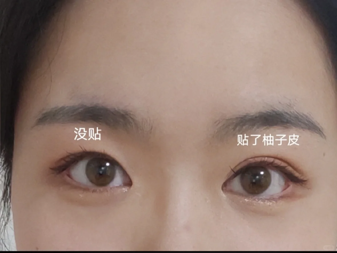旅游忘带双眼皮贴，盯上了柚子皮